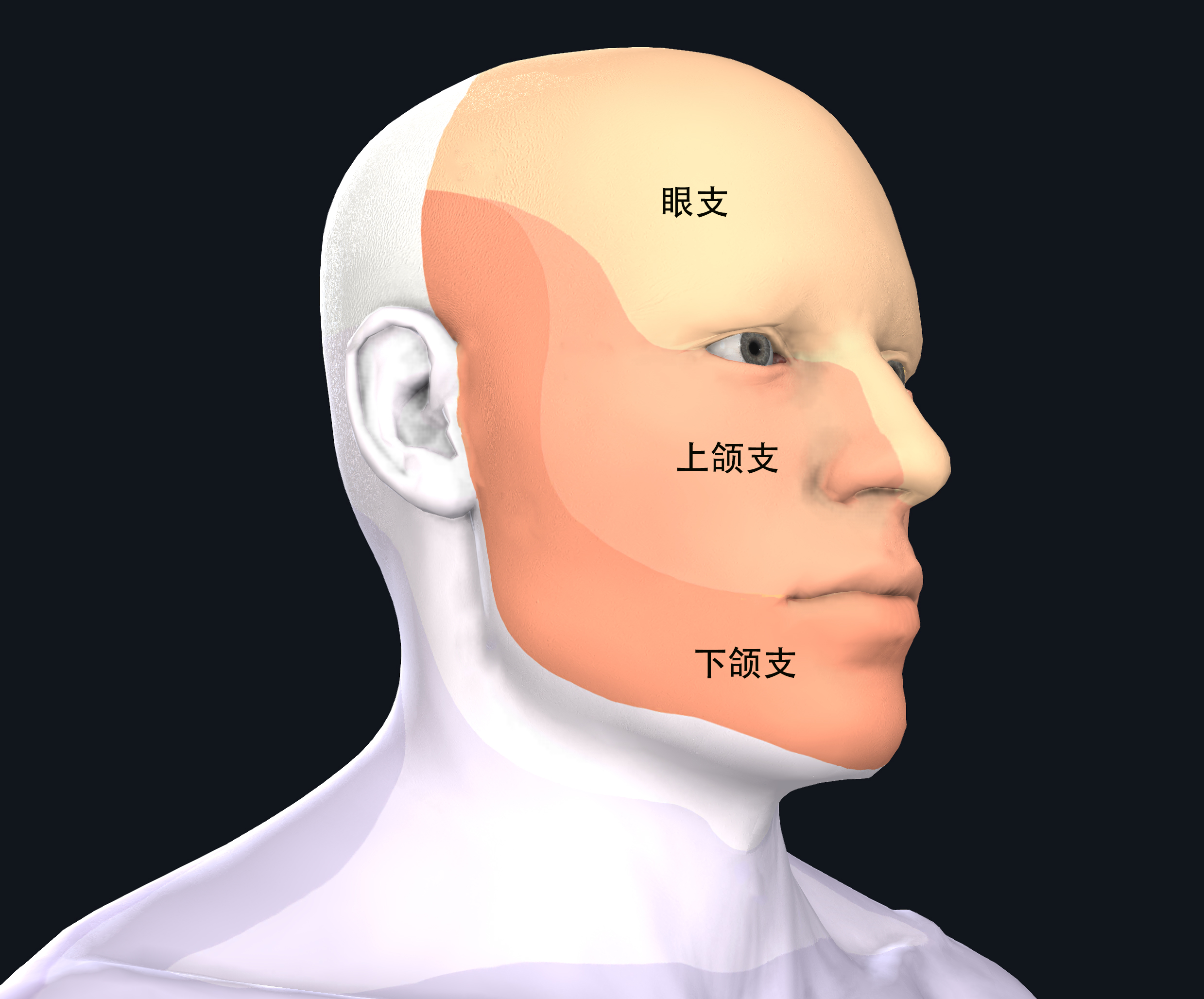 ICHD3三叉神经痛的诊断原则